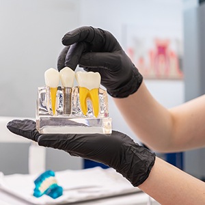 Person with gloved hands holding dental implant model