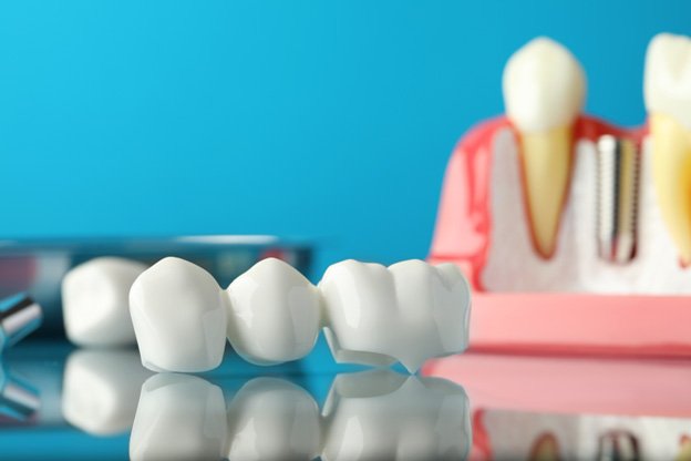 Woman rubbing her jaw and explaining symptoms to dentist