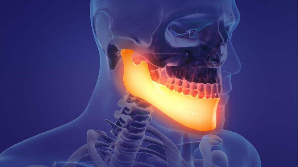 Animation of a painful mandible