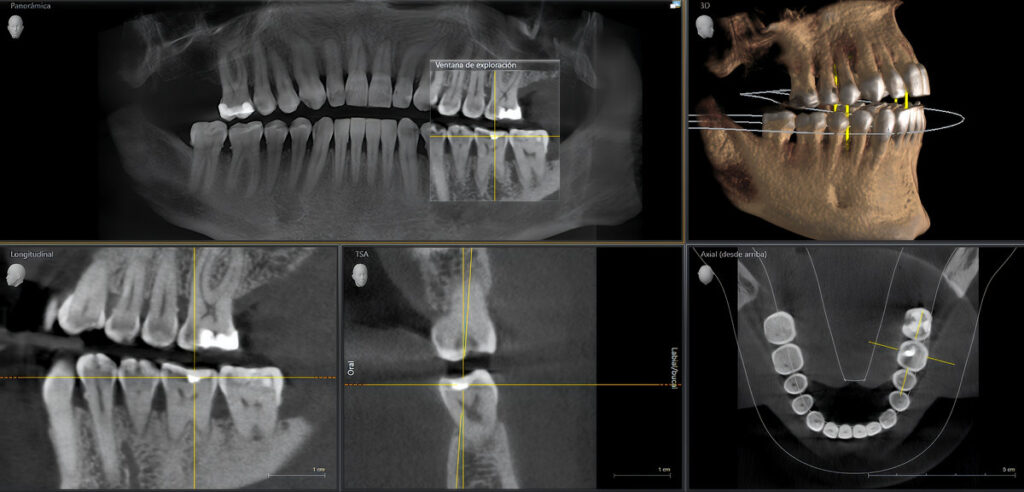 Multiview dental cbct scan for comprehensive oral and jaw analysis, aiding diagnosis and treatment planning in dentistry