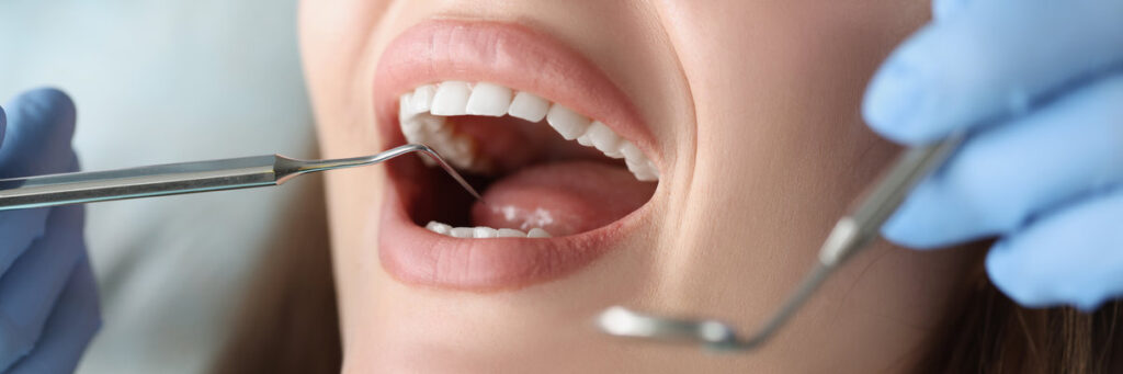 Dentist examines oral cavity of woman patient