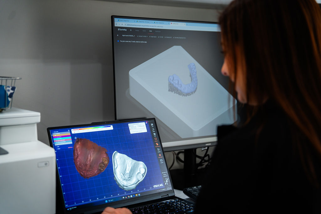 customization of a dental procedure